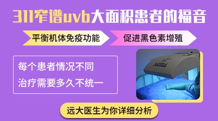 311窄谱uvb治疗仪照好白斑多少钱