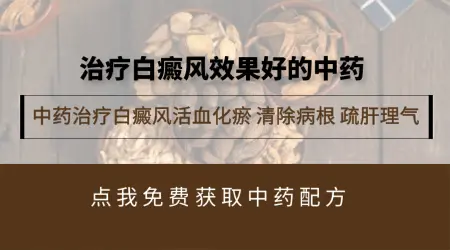 中药治白癜风效果大不大