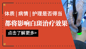 白癜风的症状长什么样子 白癜风的治疗方法有哪些