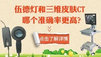 确诊白癜风是皮肤ct还是伍德灯