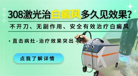 白癜风照光仪器管用吗