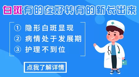 308治白癜风一边好转一边新发白斑