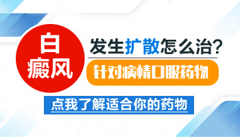 手部胸部都有白癜风还在发展怎么治