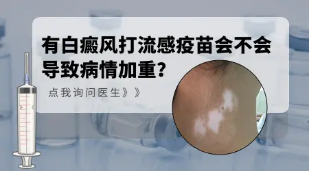 白癜风患者能打流感疫苗吗