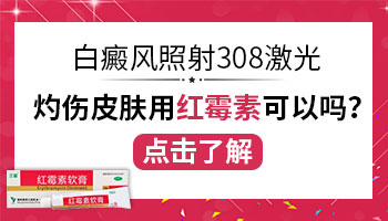 白癜风患者照射308激光治疗会有哪些后果