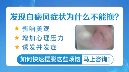 发际线有块小白斑是怎么回事