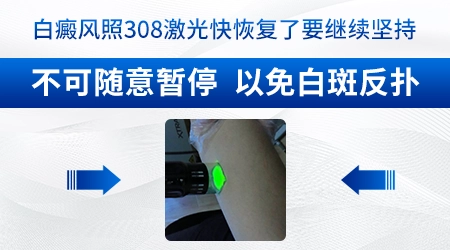 儿童身上顽固白斑308激光能治好吗