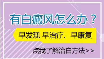 伍德灯照白斑显示阳性就是白癜风吗