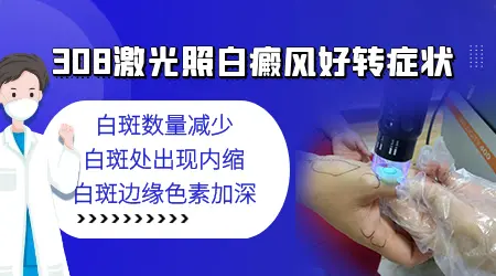 白斑照射308激光好转迹象