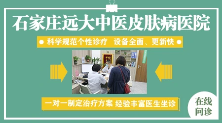 石家庄治疗白斑效果怎么样