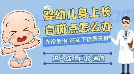 婴幼儿白癜风怎么治