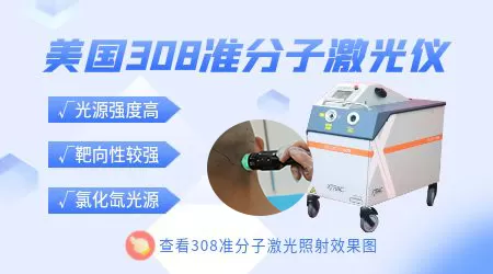 308准分子激光治疗仪哪个品牌好