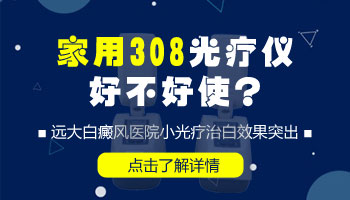 哪里有卖白癜风小光疗机的