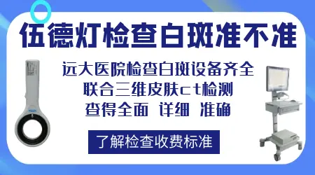 伍德灯检查白斑准不准