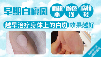 新生儿大腿内侧发白图片