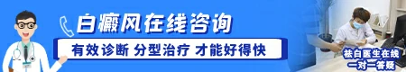 看图分辨白斑是什么病 白斑检查项目