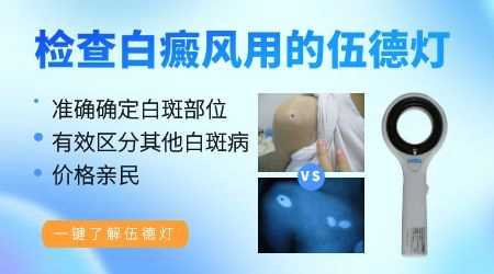 男生大腿光滑的白斑是不是白癜风