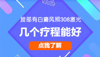 脸上白癜风有扩散趋势如何治疗好