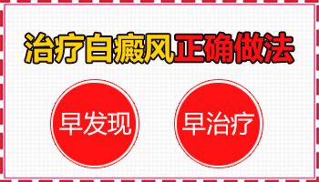 白癜风患者会不会更容易感染新冠 怎么预防