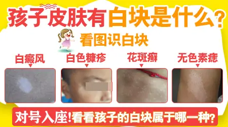 小孩胳膊上有几个小白点怎么回事