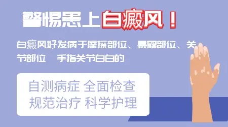 白癜风是从哪儿开始出来的