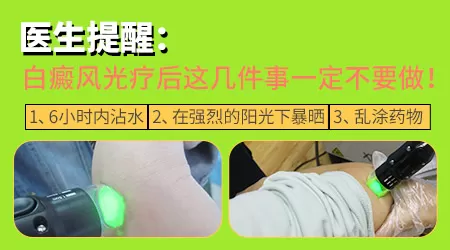 面部的白癜风照308准分子几次就能好