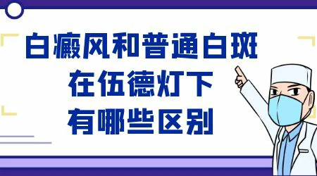 初期白癜风伍德灯能检查出来吗 伍德灯确诊白斑准吗