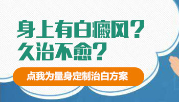 双臂白癜风的症状有哪些