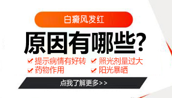 有遗传史的怎么预防白癜风效果好?