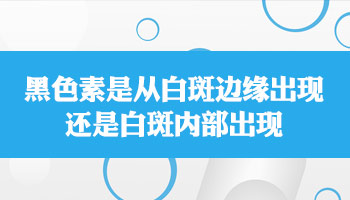 普通小片的白癜风治疗费用是多少