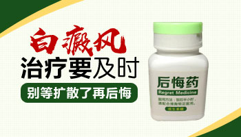 脸上白斑可以用卤米松