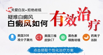 瓷白色白癜风用什么方法治疗好的快