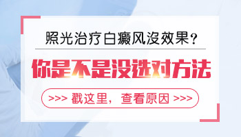 白癜风治疗误区大盘点  白白们要注意