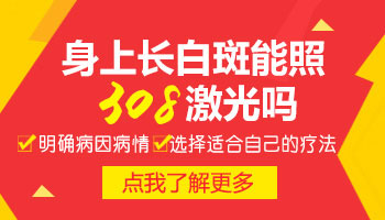 稳定性白癜风照308效果怎么样