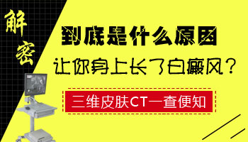 这些都是白癜风的高发部位 你应该懂得如何预防