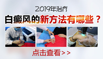 2019年都在这样治疗白癜风 你知道吗