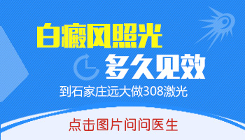 照308准分子激光白癜风多长时间能变黑