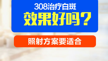 激光照白癜风后期好转速度很慢是为什么