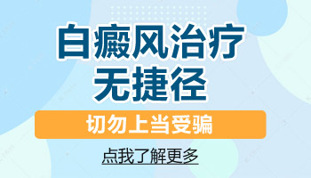 这些错误的白癜风治疗方式 你中招了吗