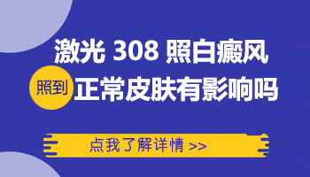 白癜风用了308会皮肤发硬吗