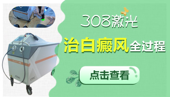 白癜风用308激光治疗还要不要输液