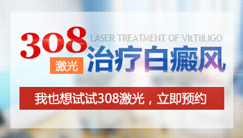 308激光治白斑的价格是多少