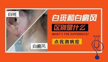 白斑和白癜风的区别 别再傻傻分不清楚