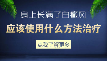 308激光和窄谱311照白癜风区别都是什么