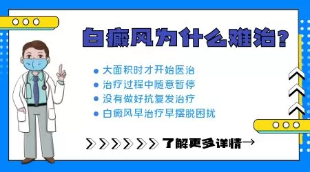 白斑病有哪些治疗的方法