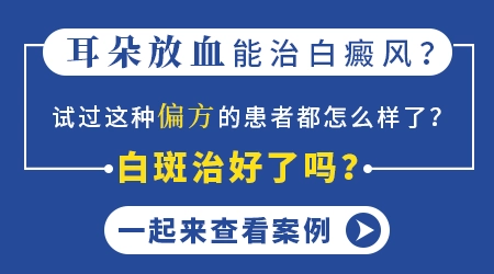 耳朵放血能不能治好白癜风