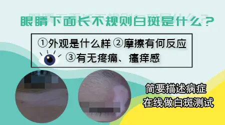 眼睛周围出现光滑的白点