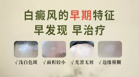 点状白斑不在一处是白癜风吗