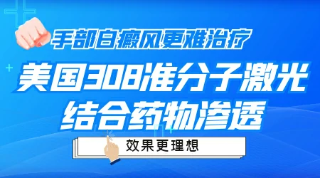 手部白斑光照308激光可否不吃药