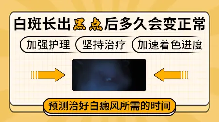 308激光治疗白斑照几次长黑点